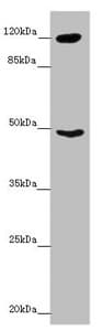 Polyclonal Rabbit anti-Human INPP4A Antibody (IHC, WB)