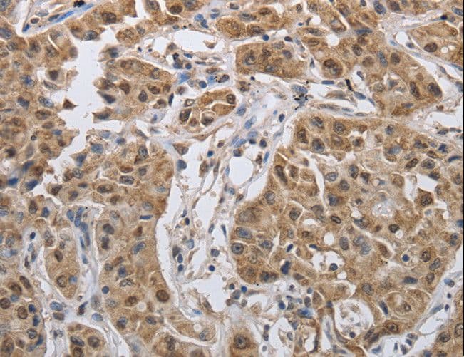 PRKAR1B Antibody