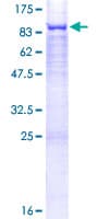 Human GALNT13 Protein (Recombinant GST)