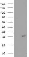 CDKN3 / KAP Antibody (clone OTI5H1)