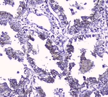 GOLPH3 Antibody