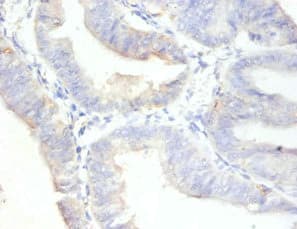 MKI67 / Ki67 Antibody