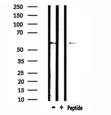 Polyclonal Rabbit anti-Human THBD / CD141 / Thrombomodulin Antibody (IF, WB)