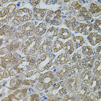 Polyclonal Rabbit anti-Human CHRFAM7A Antibody (IHC, WB)