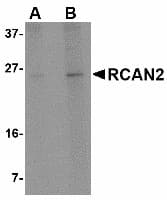IHC-plus™ RCAN2 / RCN2 Antibody