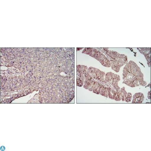 CD276 / B7-H3 Antibody