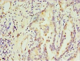 Polyclonal Rabbit anti-Human STX3 / Syntaxin 3 Antibody (aa1-263, IHC)