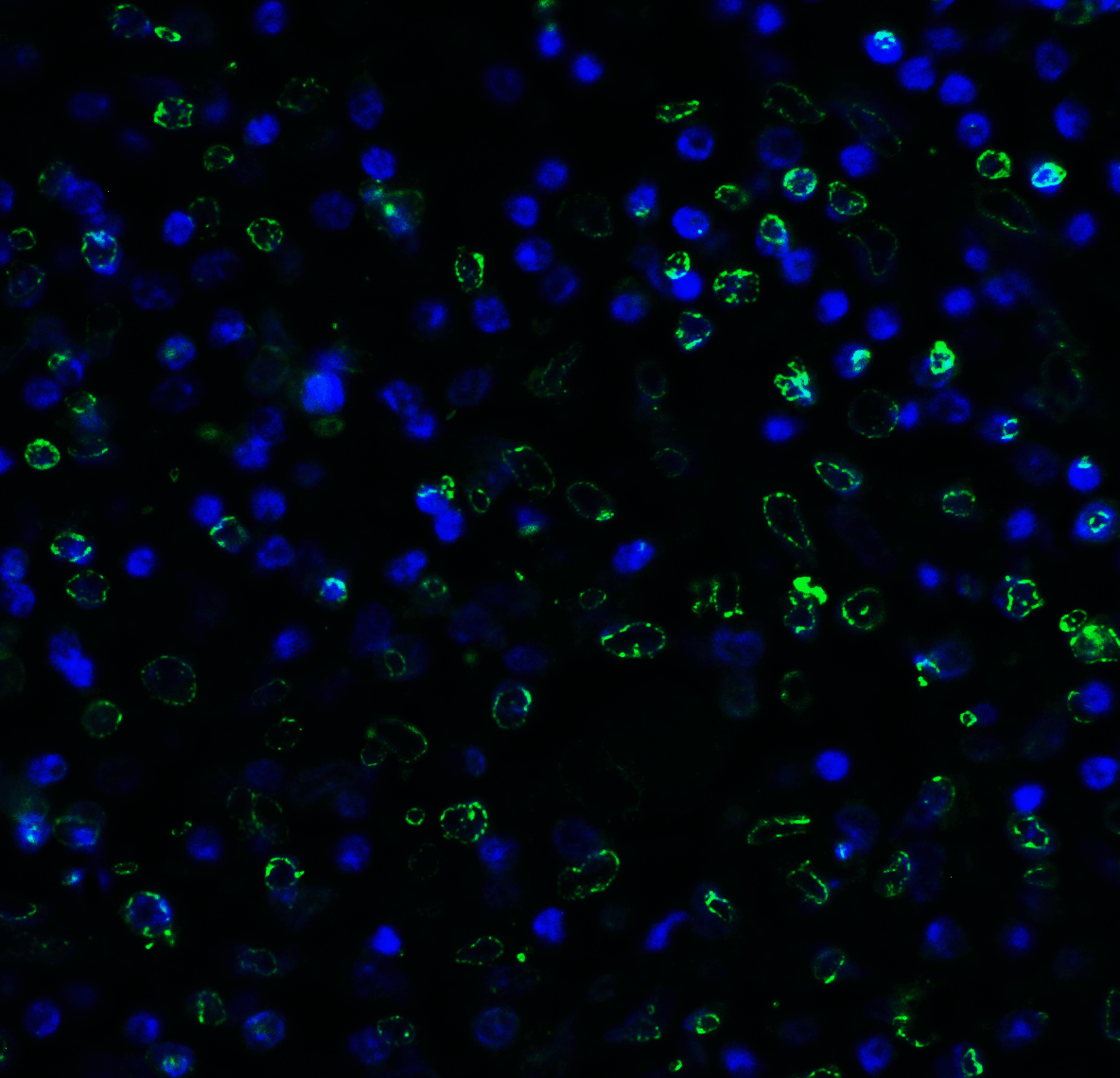 TIGIT Antibody (clone 7.00E+05)
