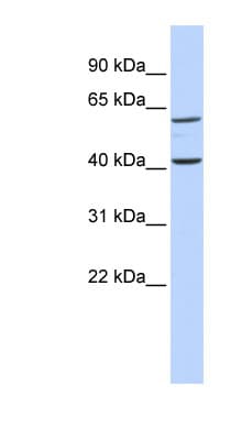 Polyclonal Rabbit anti-Human TCTN3 Antibody (aa215-264, WB)