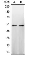 CASP9 / Caspase 9 Antibody (Internal)