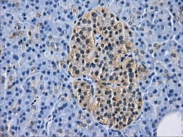 HDAC10 Antibody (clone OTI6G5)