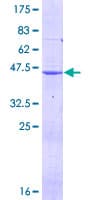 Human DHFR Protein (Recombinant GST)