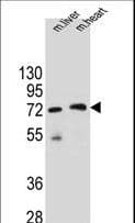 KCTD8 Antibody (aa434-462)