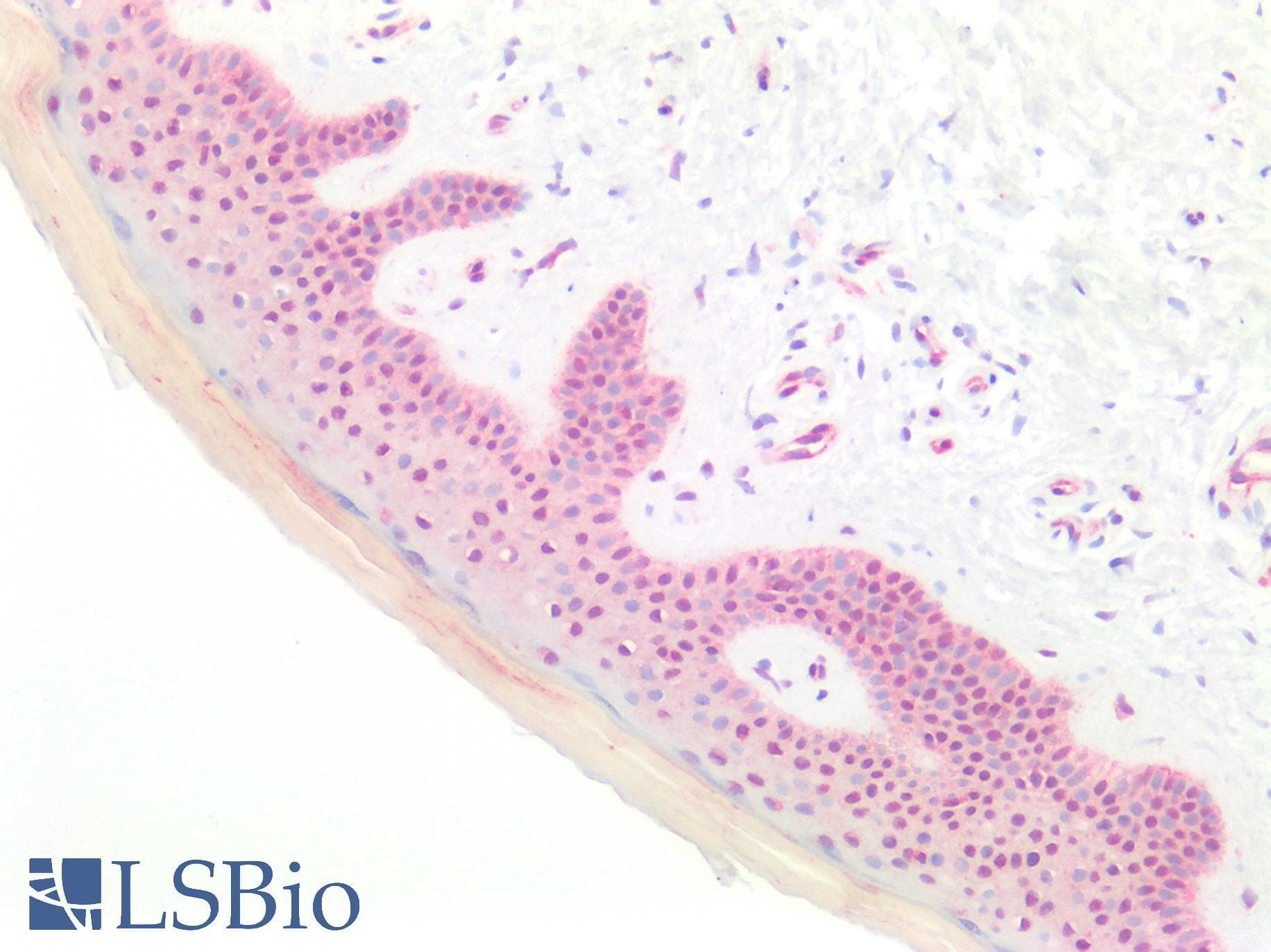 LMX1B Antibody