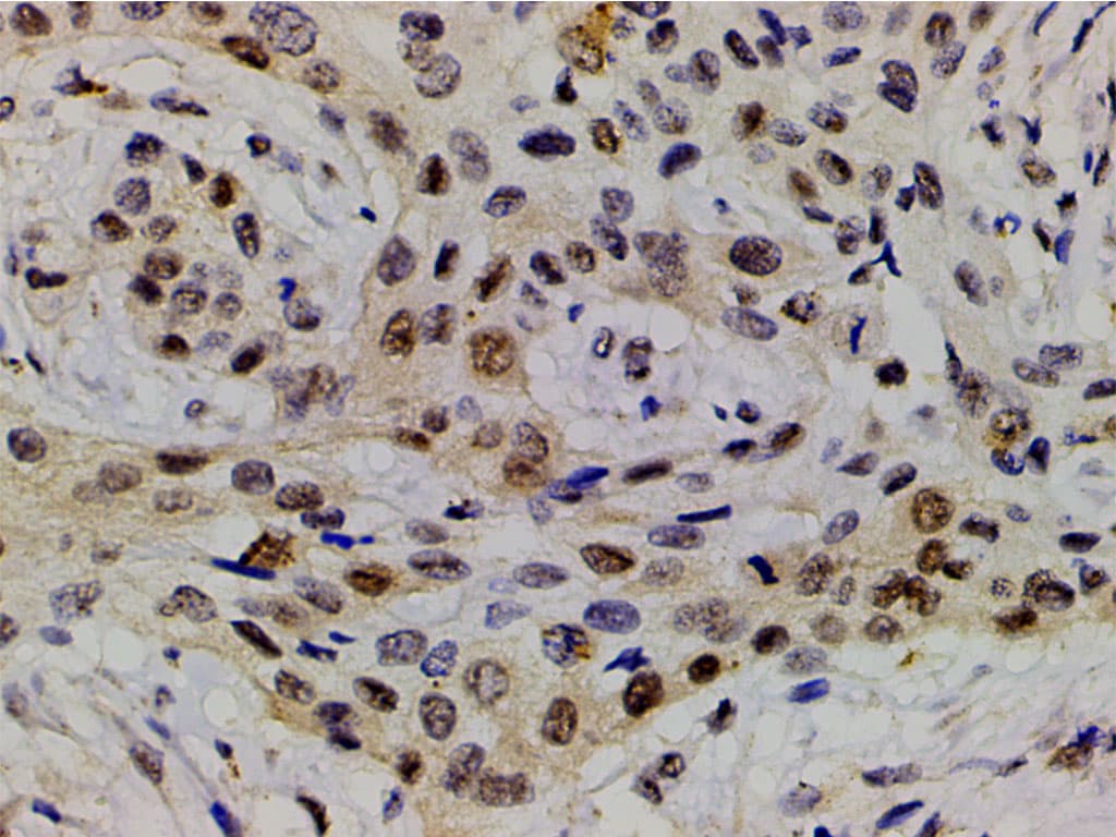 LIMK1 / LIMK Antibody (phospho-Thr508)