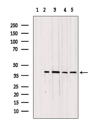 TOMM40 / TOM40 Antibody