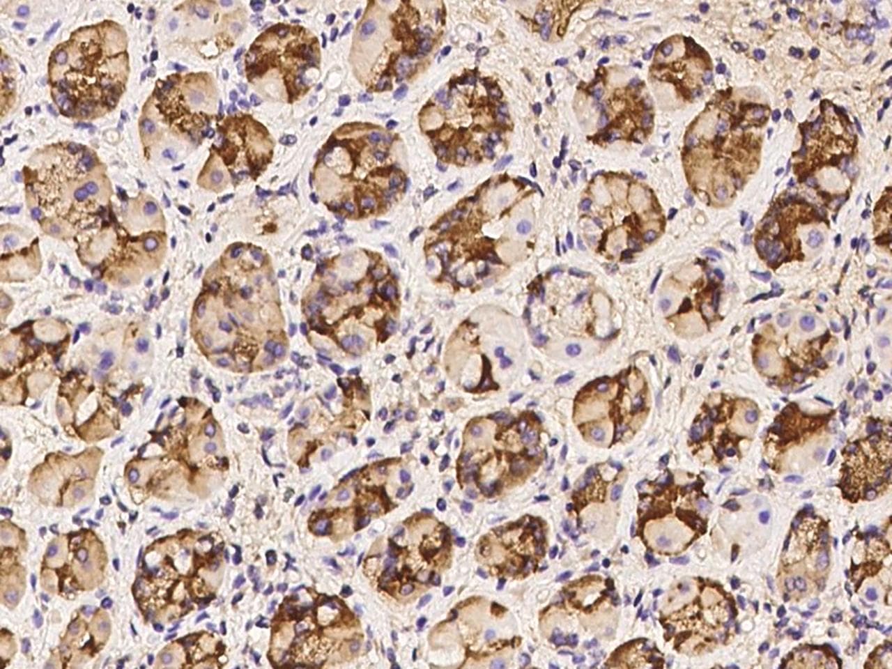 LIPF / GL / Gastric Lipase Antibody