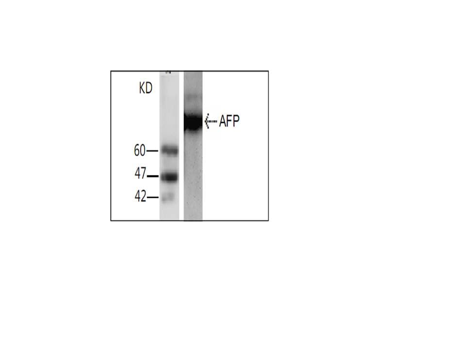 IHC-plus™ Monoclonal Mouse anti-Human Alpha-Fetoprotein Antibody (IHC, WB)