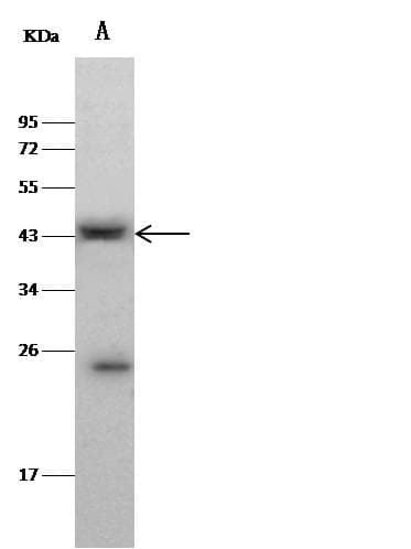 Polyclonal Rabbit anti-Human CLEC9A Antibody (Preservative Free, WB)
