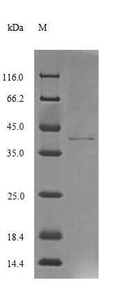 Human PCBD1 / PHS Protein (Recombinant GST-6His, N-terminus)