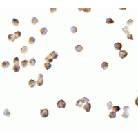 RICK / RIP2 Antibody