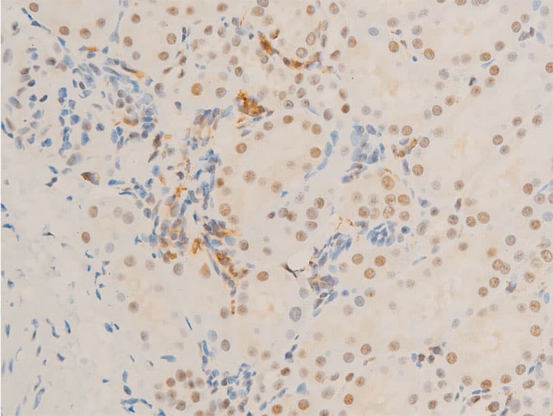 Polyclonal Rabbit anti-Human MYC / c-Myc Antibody (phospho-Ser62, IHC, IF, WB)