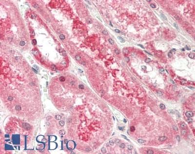 IHC-plus™ BCL10 / BCL-10 Antibody (C-Terminus)