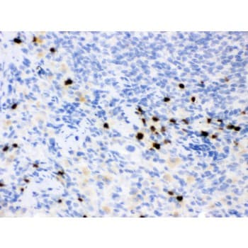 Polyclonal Rabbit anti-Rat LCN2 / Lipocalin 2 / NGAL Antibody (aa21-198, IHC, WB)