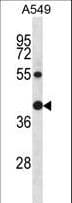 RAD23B / HR23B Antibody (aa11-40)