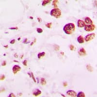 TINF2 Antibody (Internal)