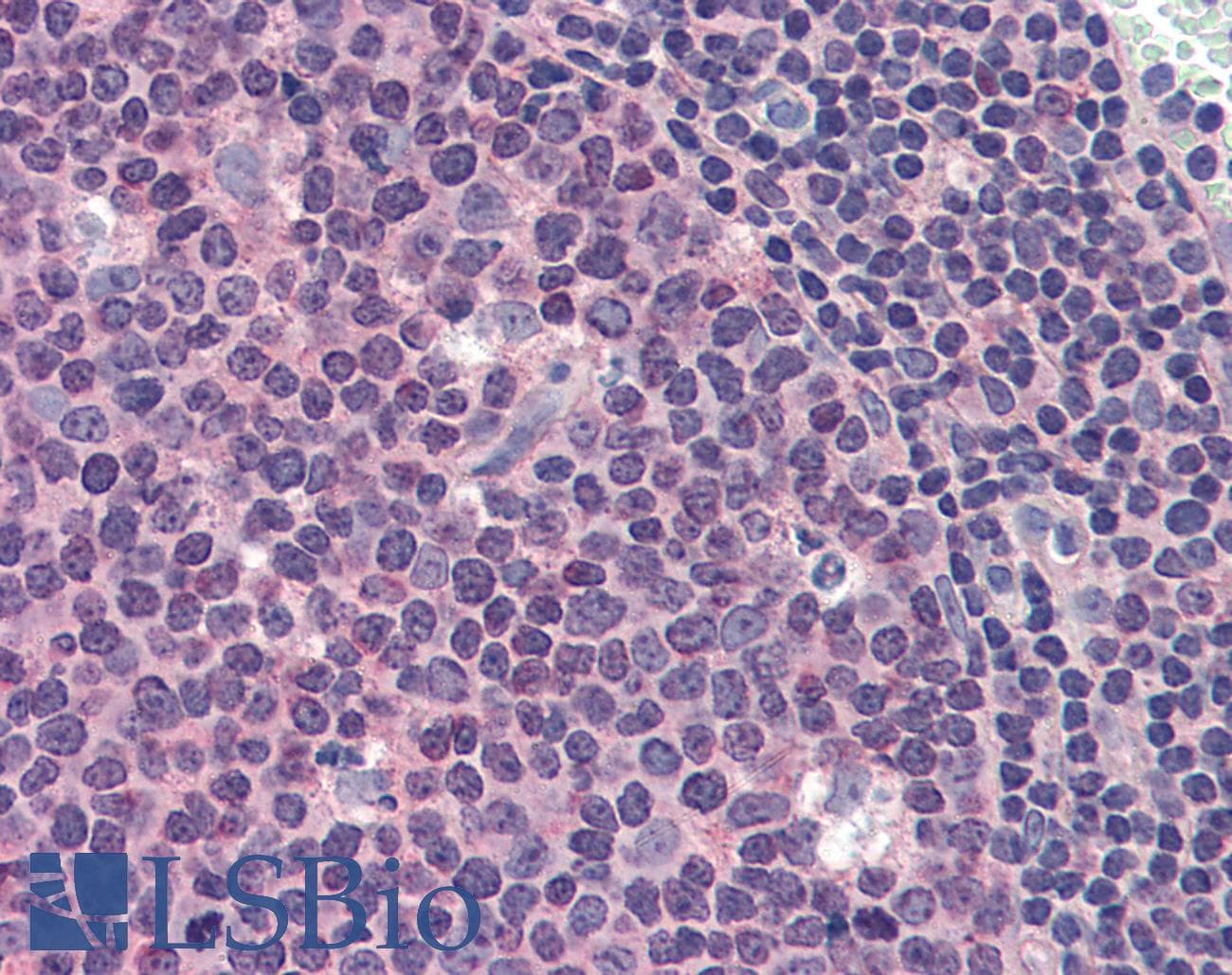 IHC-plus™ Monoclonal Mouse anti-Human MCL1 / MCL 1 Antibody (clone 8C6D4B1, IHC, WB)