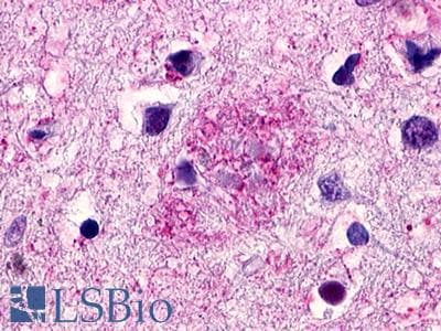 PathPlus™ Polyclonal Rabbit anti-Human GPR119 Antibody (Cytoplasmic Domain, IHC)