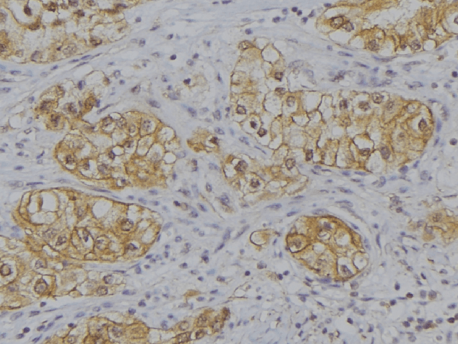 CALCA Antibody
