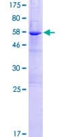Human NIT2 Protein (Recombinant GST)