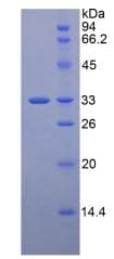 Human LRP5 Protein (Recombinant His, N-Terminal)
