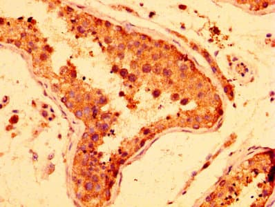 HUFI-2 / LRRFIP2 Antibody