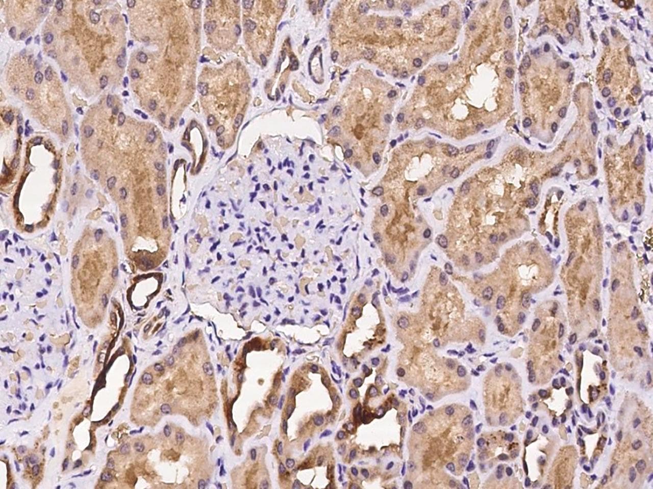 Polyclonal Rabbit anti-Human NECAP2 Antibody (IHC)