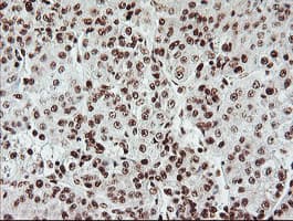 EXOSC7 Antibody (clone OTI1G8)