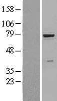 GUSB / Beta Glucuronidase Protein (Over-Expression Lysate Myc-DDK (Flag))