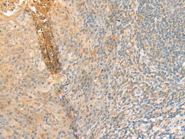 GPT2 / ALT2 Antibody