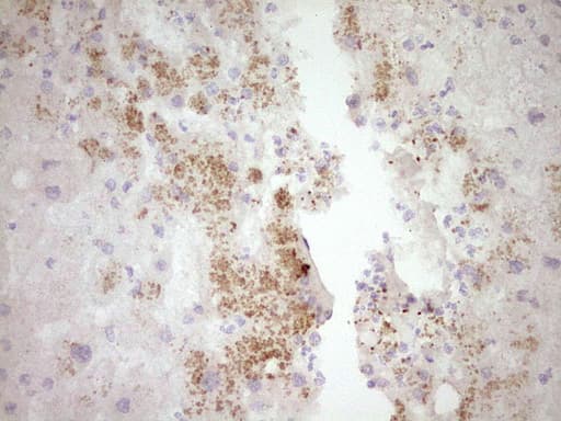 Monoclonal Mouse anti-Human SPP1 / Osteopontin Antibody (clone OTI2F2, aa17-314, IHC, WB)