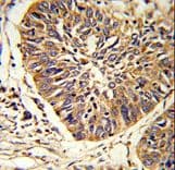 PDIA3 / ERp57 Antibody (aa446-475)