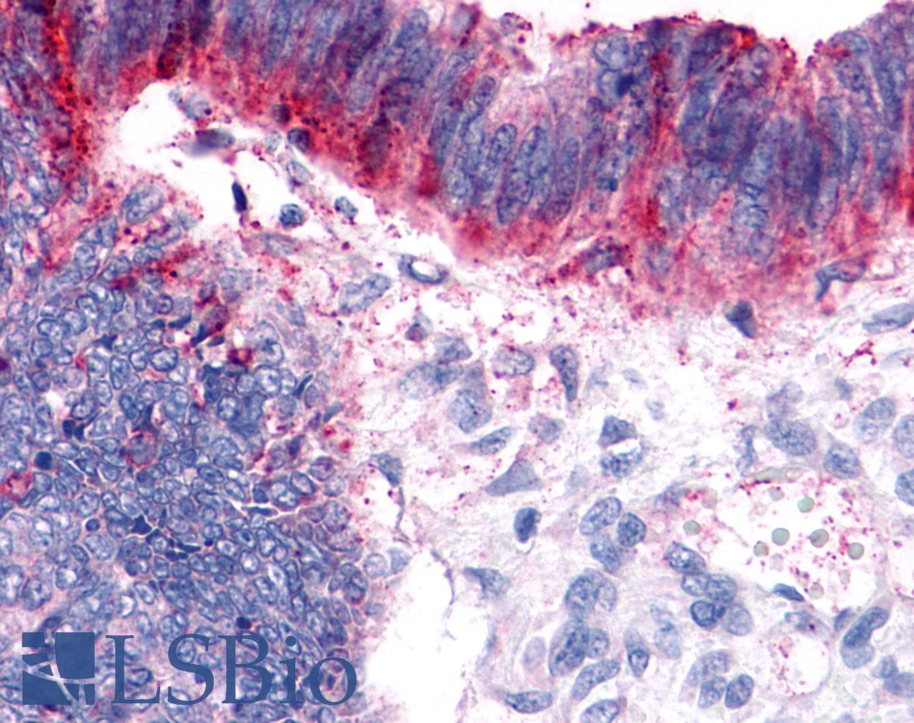 PathPlus™ Polyclonal Rabbit anti-Human GPER1 / GPR30 Antibody (Extracellular Domain, IHC, IF)