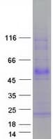 Human TMEFF1 / Tomoregulin 1 Protein (Recombinant Myc-DDK (Flag))
