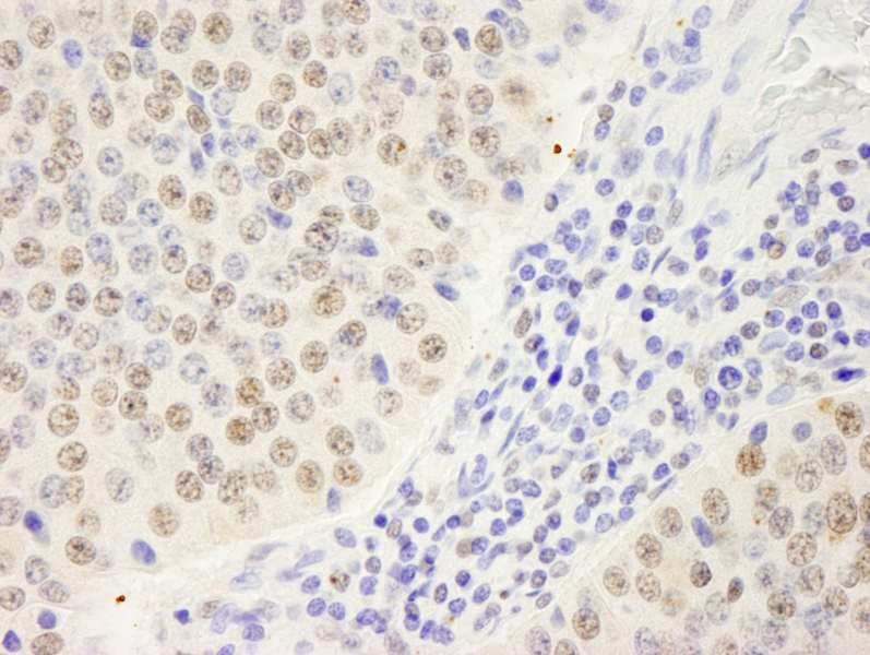 SYMPK / Symplekin Antibody (aa1224-1274)