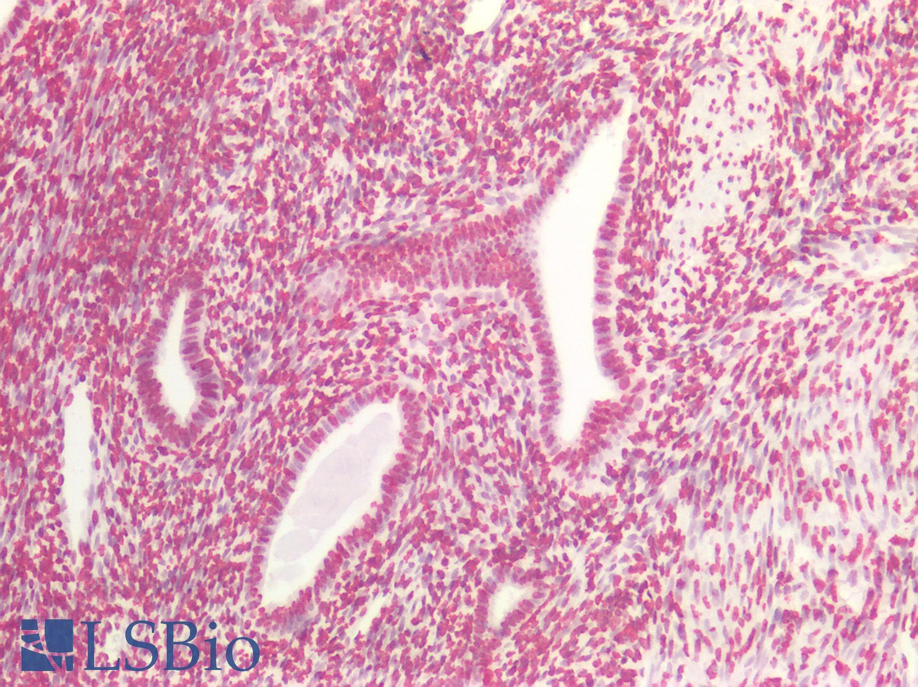 PathPlus™ Monoclonal Mouse anti-Human BRCA1 Antibody (clone 8F7, aa341-748, IHC, WB)