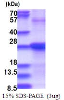 Human SDF2 Protein (Recombinant His)