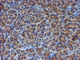 ER Alpha / Estrogen Receptor Antibody (clone OTI1B1)