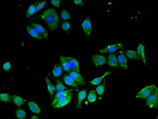 EDNRB / Endothelin B Receptor Antibody
