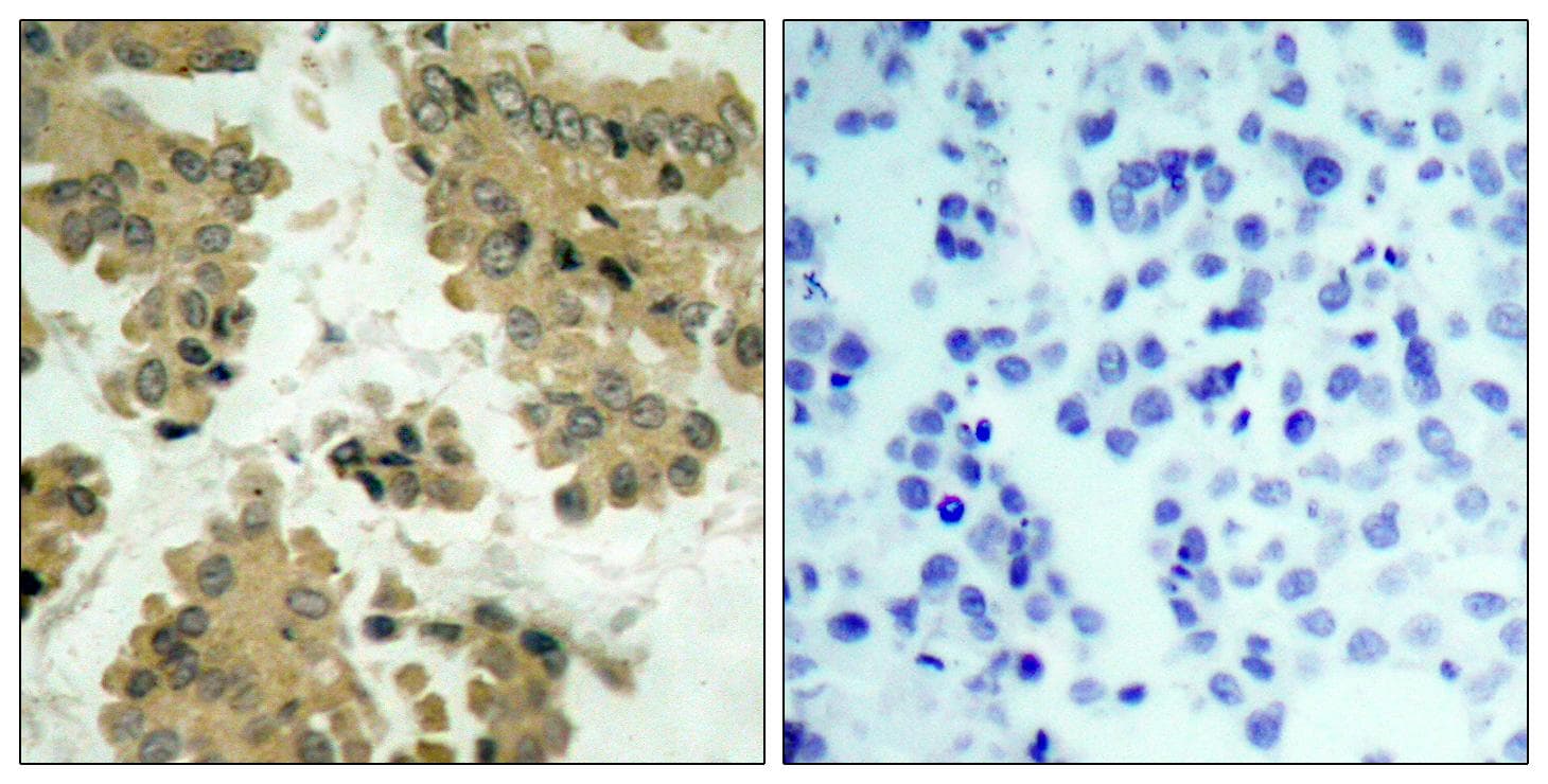 Polyclonal Rabbit anti-Human AKT2 Antibody (p474, IHC, WB)